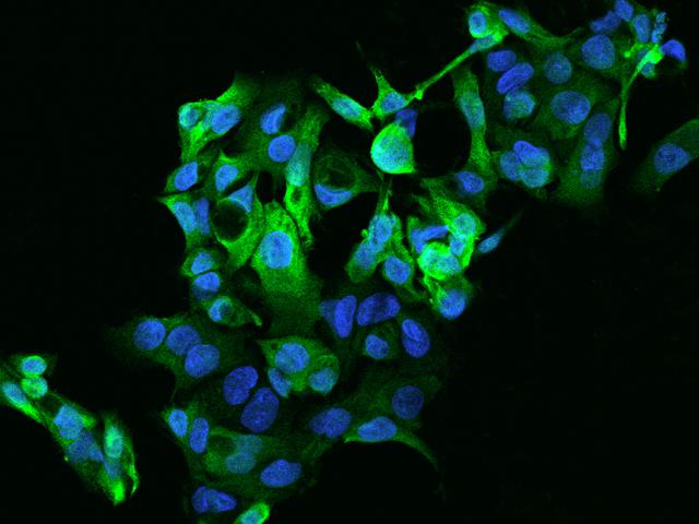 ADH4 Antibody - Immunofluorescence staining of ADH4 in HepG2 cells. Cells were fixed with 4% PFA, permeabilzed with 0.1% Triton X-100 in PBS, blocked with 10% serum, and incubated with rabbit anti-Human ADH4 polyclonal antibody (dilution ratio 1:200) at 4°C overnight. Then cells were stained with the Alexa Fluor 488-conjugated Goat Anti-rabbit IgG secondary antibody (green) and counterstained with DAPI (blue). Positive staining was localized to Cytoplasm.