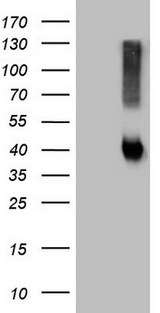 ADH5 Antibody - HEK293T cells were transfected with the pCMV6-ENTRY control. (Left lane) or pCMV6-ENTRY ADH5. (Right lane) cDNA for 48 hrs and lysed. Equivalent amounts of cell lysates. (5 ug per lane) were separated by SDS-PAGE and immunoblotted with anti-ADH5.