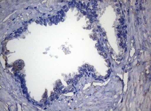 ADH5 Antibody - Immunohistochemical staining of paraffin-embedded Human prostate tissue within the normal limits using anti-ADH5 mouse monoclonal antibody. (Heat-induced epitope retrieval by 1mM EDTA in 10mM Tris buffer. (pH8.5) at 120°C for 3 min. (1:150)