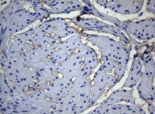ADH5 Antibody - Immunohistochemical staining of paraffin-embedded Human bladder tissue within the normal limits using anti-ADH5 mouse monoclonal antibody. (Heat-induced epitope retrieval by 1mM EDTA in 10mM Tris buffer. (pH8.5) at 120°C for 3 min. (1:150)