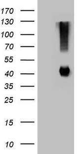 ADH5 Antibody - HEK293T cells were transfected with the pCMV6-ENTRY control. (Left lane) or pCMV6-ENTRY ADH5. (Right lane) cDNA for 48 hrs and lysed. Equivalent amounts of cell lysates. (5 ug per lane) were separated by SDS-PAGE and immunoblotted with anti-ADH5.