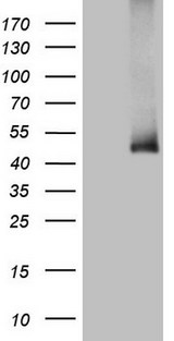 ADH5 Antibody - HEK293T cells were transfected with the pCMV6-ENTRY control. (Left lane) or pCMV6-ENTRY ADH5. (Right lane) cDNA for 48 hrs and lysed. Equivalent amounts of cell lysates. (5 ug per lane) were separated by SDS-PAGE and immunoblotted with anti-ADH5. (1:2000)