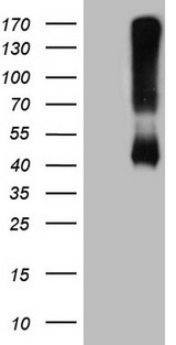 ADH5 Antibody - HEK293T cells were transfected with the pCMV6-ENTRY control. (Left lane) or pCMV6-ENTRY ADH5. (Right lane) cDNA for 48 hrs and lysed. Equivalent amounts of cell lysates. (5 ug per lane) were separated by SDS-PAGE and immunoblotted with anti-ADH5. (1:2000)