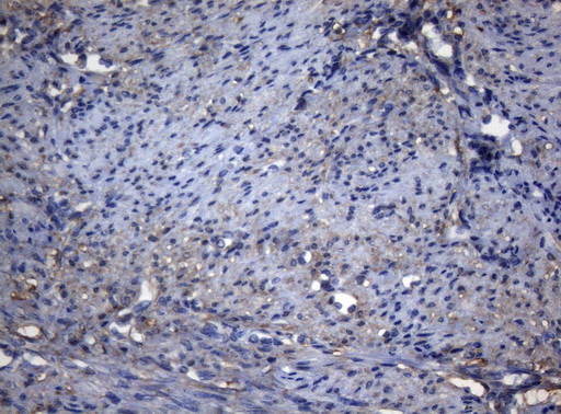 ADH5 Antibody - Immunohistochemical staining of paraffin-embedded Human endometrium tissue within the normal limits using anti-ADH5 mouse monoclonal antibody. (Heat-induced epitope retrieval by 1mM EDTA in 10mM Tris buffer. (pH8.5) at 120°C for 3 min. (1:150)