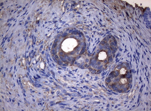 ADH5 Antibody - Immunohistochemical staining of paraffin-embedded Human prostate tissue within the normal limits using anti-ADH5 mouse monoclonal antibody. (Heat-induced epitope retrieval by 1mM EDTA in 10mM Tris buffer. (pH8.5) at 120°C for 3 min. (1:150)