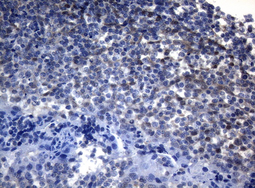 ADH5 Antibody - Immunohistochemical staining of paraffin-embedded Human tonsil within the normal limits using anti-ADH5 mouse monoclonal antibody. (Heat-induced epitope retrieval by 1mM EDTA in 10mM Tris buffer. (pH8.5) at 120°C for 3 min. (1:150)