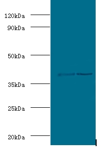 ADH5 Antibody - Western blot of Alcohol dehydrogenase class-3 antibody at 2 ug/ml lane 1: mouse liver tissue lane 2: mouse kidney tissue Secondary.  This image was taken for the unconjugated form of this product. Other forms have not been tested.