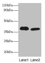 ADH5 Antibody - Western blot All lanes: Alcohol dehydrogenase class-3 antibody at 2µg/ml Lane 1: Mouse liver tissue Lane 2: Mouse kidney tissue Secondary Goat polyclonal to rabbit IgG at 1/10000 dilution Predicted band size: 40 kDa Observed band size: 40 kDa
