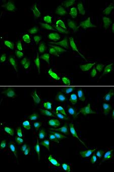 ADH5 Antibody - Immunofluorescence analysis of HepG2 cells.