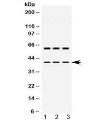 ADH5 Antibody - Western blot testing of 1) rat brain, 2) mouse brain and 3) human HepG2 lysate with ADH5 antibody at 0.5ug/ml. Predicted molecular weight ~40 kDa.