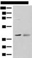 ADH5 Antibody - Western blot analysis of Mouse kidney tissue and Human fetal brain tissue lysates  using ADH5 Polyclonal Antibody at dilution of 1:500