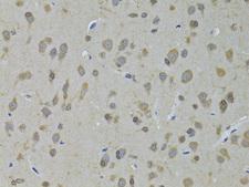 ADH5 Antibody - Immunohistochemistry of paraffin-embedded Rat brain using ADH5 Polyclonal Antibody at dilution of 1:100 (40x lens).