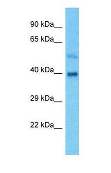 ADH5 Antibody - Western blot of ADH5 Antibody with human Fetal Lung lysate.  This image was taken for the unconjugated form of this product. Other forms have not been tested.