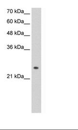 ADH6 Antibody - HepG2 Cell Lysate.  This image was taken for the unconjugated form of this product. Other forms have not been tested.
