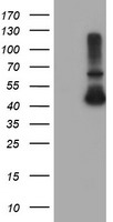 ADH7 Antibody - HEK293T cells were transfected with the pCMV6-ENTRY control (Left lane) or pCMV6-ENTRY ADH7 (Right lane) cDNA for 48 hrs and lysed. Equivalent amounts of cell lysates (5 ug per lane) were separated by SDS-PAGE and immunoblotted with anti-ADH7.