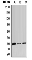 ADH7 Antibody - Western blot analysis of ADH7 expression in HeLa (A); SP2/0 (B); PC12 (C) whole cell lysates.