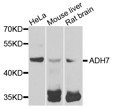 ADH7 Antibody - Western blot analysis of extracts of various cells.