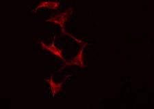 ADH7 Antibody - Staining HeLa cells by IF/ICC. The samples were fixed with PFA and permeabilized in 0.1% Triton X-100, then blocked in 10% serum for 45 min at 25°C. The primary antibody was diluted at 1:200 and incubated with the sample for 1 hour at 37°C. An Alexa Fluor 594 conjugated goat anti-rabbit IgG (H+L) antibody, diluted at 1/600, was used as secondary antibody.