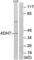 ADH7 Antibody - Western blot analysis of extracts from COS cells, using ADH7 antibody.