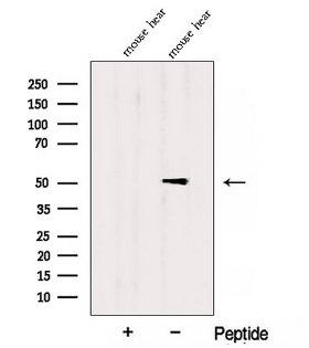 ADHFE1 Antibody - Western blot analysis of extracts of mouse heart tissue using ADHFE1 antibody. The lane on the left was treated with blocking peptide.