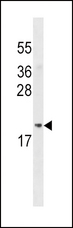 ADI1 / ARD Antibody - ADI1 Antibody western blot of MDA-MB453 cell line lysates (35 ug/lane). The ADI1 antibody detected the ADI1 protein (arrow).