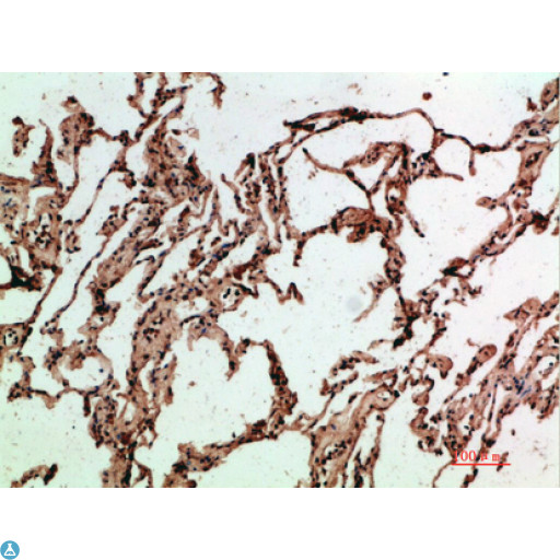 ADI1 / ARD Antibody - Immunohistochemical analysis of paraffin-embedded human-lung, antibody was diluted at 1:200.