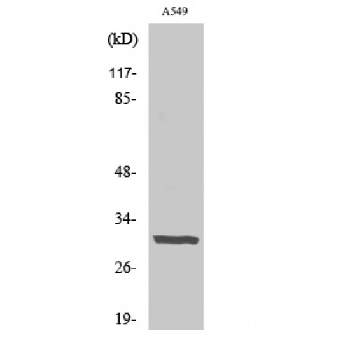 Adiponectin Antibody - Western blot of Adiponectin antibody