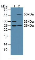 Adiponectin Antibody - Western Blot; Sample: Lane1: Rat Serum; Lane2: Rat Uterus Tissue.
