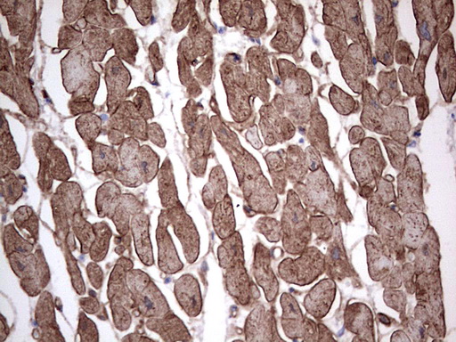 Adiponectin Antibody - Immunohistochemical staining of paraffin-embedded Human adult heart tissue using anti-ADIPOQ Mouse monoclonal antibody.  heat-induced epitope retrieval by 1 mM EDTA in 10mM Tris, pH8.5, 120C for 3min)