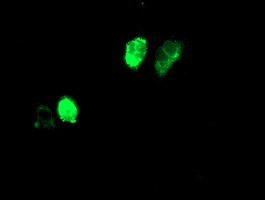 Adiponectin Antibody - Anti-ADIPOQ mouse monoclonal antibody immunofluorescent staining of COS7 cells transiently transfected by pCMV6-ENTRY ADIPOQ.
