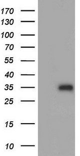 Adiponectin Antibody - HEK293T cells were transfected with the pCMV6-ENTRY control (Left lane) or pCMV6-ENTRY ADIPOQ (Right lane) cDNA for 48 hrs and lysed. Equivalent amounts of cell lysates (5 ug per lane) were separated by SDS-PAGE and immunoblotted with anti-ADIPOQ.