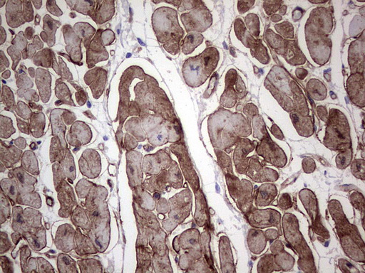 Adiponectin Antibody - IHC of paraffin-embedded Human adult heart tissue using anti-ADIPOQ Mouse monoclonal antibody. (heat-induced epitope retrieval by 1 mM EDTA in 10mM Tris, pH8.5, 120°C for 3min).