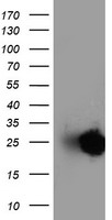 Adiponectin Antibody - HEK293T cells were transfected with the pCMV6-ENTRY control (Left lane) or pCMV6-ENTRY ADIPOQ (Right lane) cDNA for 48 hrs and lysed. Equivalent amounts of cell lysates (5 ug per lane) were separated by SDS-PAGE and immunoblotted with anti-ADIPOQ.