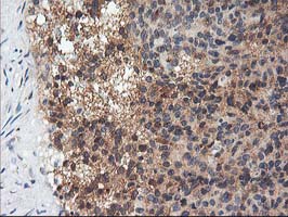 Adiponectin Antibody - IHC of paraffin-embedded Human breast tissue using anti-ADIPOQ mouse monoclonal antibody. (Heat-induced epitope retrieval by 10mM citric buffer, pH6.0, 100C for 10min).