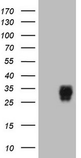 Adiponectin Antibody - HEK293T cells were transfected with the pCMV6-ENTRY control. (Left lane) or pCMV6-ENTRY ADIPOQ. (Right lane) cDNA for 48 hrs and lysed. Equivalent amounts of cell lysates. (5 ug per lane) were separated by SDS-PAGE and immunoblotted with anti-ADIPOQ. (1:2000)