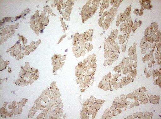 Adiponectin Antibody - Immunohistochemical staining of paraffin-embedded Human placenta tissue within the normal limits using anti-ADIPOQ mouse monoclonal antibody. (Heat-induced epitope retrieval by 1mM EDTA in 10mM Tris buffer. (pH8.5) at 120 oC for 3 min. (1:150)