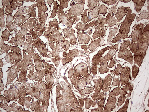 Adiponectin Antibody - Immunohistochemical staining of paraffin-embedded Human adult heart tissue using anti-ADIPOQ mouse monoclonal antibody. (Heat-induced epitope retrieval by 1 mM EDTA in 10mM Tris, pH8.5, 120C for 3min,