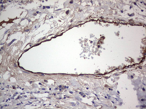 Adiponectin Antibody - IHC of paraffin-embedded Human colon tissue using anti-ADIPOQ mouse monoclonal antibody. (Heat-induced epitope retrieval by 1 mM EDTA in 10mM Tris, pH8.5, 120°C for 3min).