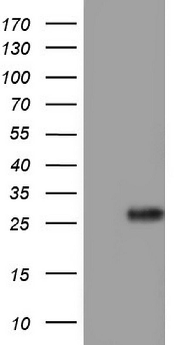 Adiponectin Antibody - HEK293T cells were transfected with the pCMV6-ENTRY control. (Left lane) or pCMV6-ENTRY ADIPOQ. (Right lane) cDNA for 48 hrs and lysed. Equivalent amounts of cell lysates. (5 ug per lane) were separated by SDS-PAGE and immunoblotted with anti-ADIPOQ.