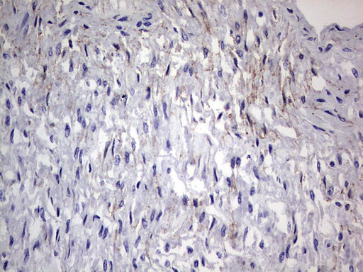Adiponectin Antibody - Immunohistochemical staining of paraffin-embedded Human muscle tissue using anti-ADIPOQ mouse monoclonal antibody. (Heat-induced epitope retrieval by 1 mM EDTA in 10mM Tris, pH8.5, 120C for 3min,