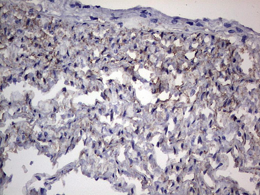 Adiponectin Antibody - Immunohistochemical staining of paraffin-embedded Human muscle tissue using anti-ADIPOQ mouse monoclonal antibody. (Heat-induced epitope retrieval by 1 mM EDTA in 10mM Tris, pH8.5, 120C for 3min,
