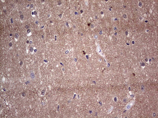 Adiponectin Antibody - Immunohistochemical staining of paraffin-embedded Human embryonic brain cortex tissue using anti-ADIPOQ mouse monoclonal antibody. (Heat-induced epitope retrieval by 1 mM EDTA in 10mM Tris, pH8.5, 120C for 3min,