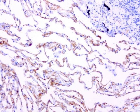 Adiponectin Antibody - Immunohistochemical staining of paraffin-embedded human lung using ADIPOQ clone UMAB104, mouse monoclonal antibody at 1:100 dilution of 1mg/mL using Polink2 Broad HRP DAB for detection.requires heat-induced epitope retrieval with Citrate pH6.0 at 110C for 3 min using pressure chamber/cooker. The image shows strong membranous and cytoplasmic staining of the endothelial cells. Normal lung epithelia cells and tumor cells are negative for ADIPOQ.
