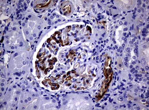Adiponectin Antibody - Immunohistochemical staining of paraffin-embedded human kidney tissue using ADIPOQ clone UMAB104, mouse monoclonal antibody. Heat-induced epitope retrieval by 10mM citric buffer pH6.0 was done at 120C for 3min in pressure chamber/cooker prior toapplication.was diluted 1:100 and detection with shown HRP enzyme and DAB chromogen. Strong cytoplasmic and membranous staining is seen in the glomeruli and vessel endothelia cells. Staining was not detected in the tubules.