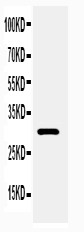 Adiponectin Antibody - WB of Adiponectin antibody. WB: Rat Heart Tissue Lysate.