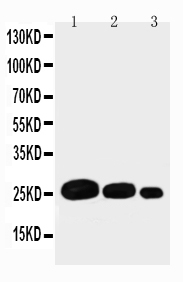 Adiponectin Antibody - WB of Adiponectin antibody. Recombinant Protein Detection Source:. E.coli derived -recombinant Human ADIPOQ, 44.4 KD. (162aa tag+ M1-N244. . Lane 1: Recombinant Human ADIPOQ Protein 10ng. Lane 2: Recombinant Human ADIPOQ Protein 5ng. . Lane 3: Recombinant Human ADIPOQ Protein 2.5ng.
