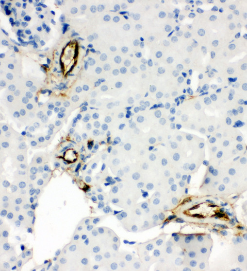 Adiponectin Antibody - Adiponectin antibody. IHC(P): Mouse Kidney Tissue.