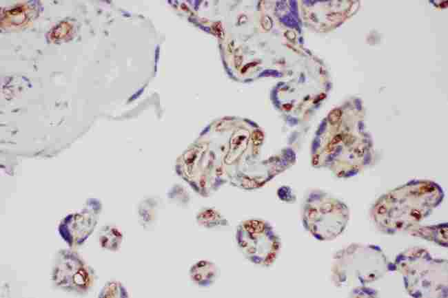 Adiponectin Antibody - anti-Adiponectin antibody IHC(P): Human Placenta Tissue