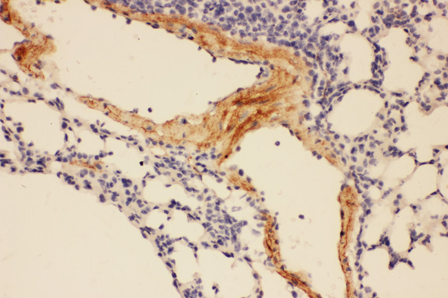Adiponectin Antibody - Adiponectin antibody. IHC(P): Mouse Lung Tissue.