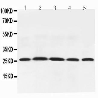 Adiponectin Antibody - WB of Adiponectin antibody. All lanes: Anti-Adiponectin at 0.5ug/ml. Lane 1: Rat Testis Tissue Lysate at 40ug. Lane 2: Rat Spleen Tissue Lysate at 40ug. Lane 3: Rat Skeletal Muscle Tissue Lysate at 40ug. Lane 4: Rat Cardiac Muscle Tissue Lysate at 40ug. Lane 5: Rat Liver Tissue Lysate at 40ug. Predicted bind size: 26KD. Observed bind size: 26KD.